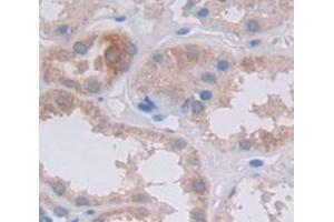 Used in DAB staining on fromalin fixed paraffin- embedded Kidney tissue (FRK Antikörper  (AA 234-491))