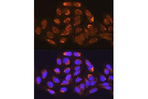 Immunofluorescence analysis of U-2 OS cells using MUT Rabbit pAb (ABIN1680932, ABIN3018357, ABIN3018358 and ABIN6220443) at dilution of 1:100 (40x lens). (MUT Antikörper  (AA 451-750))