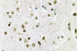 Immunohistochemistry (IHC) analyzes of DGK-theta antibody in paraffin-embedded human brain tissue. (DGKQ Antikörper)