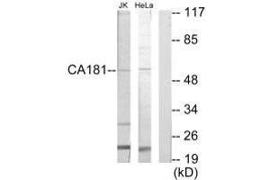 Western blot analysis of extracts from Jurkat cells and HeLa cells, using CA181 antibody. (ZNHIT6 Antikörper)