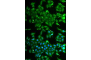 Immunofluorescence analysis of A549 cell using ANXA11 antibody.