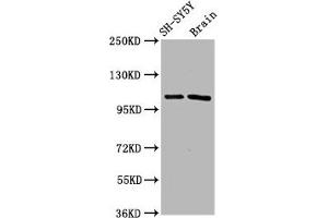 Western Blot Positive WB detected in: SH-SY5Y whole cell lysate, Rat brain tissue All lanes: FBXO10 antibody at 4. (Cyclin F Antikörper  (AA 248-400))