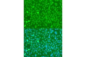 Immunofluorescence analysis of U2OS cells using UBC antibody. (UBC Antikörper  (AA 1-100))