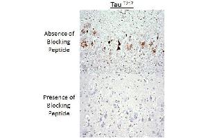Immunohistochemistry analysis of a competition assay demonstrating the specificity of the anti-Tau (Thr-217) antibody (tau Antikörper  (pThr217))