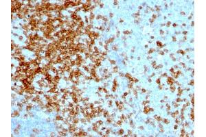 Formalin-fixed, paraffin-embedded human Tonsil stained with CD43 Mouse Monoclonal Antibody (84-3C1).
