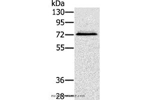 Western blot analysis of Hepg2 cell, using SSX2IP Polyclonal Antibody at dilution of 1:500 (SSX2IP Antikörper)