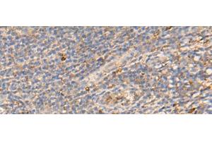 Immunohistochemistry of paraffin-embedded Human tonsil tissue using PDIA5 Polyclonal Antibody at dilution of 1:50(x200) (PDIA5 Antikörper)