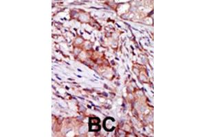 Immunohistochemistry (IHC) image for anti-KIP2 antibody (ABIN3003730) (KIP2 Antikörper)