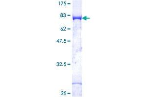 CSK Protein (AA 1-450) (GST tag)