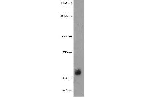 Western Blotting (WB) image for anti-Extracellular Matrix Protein 1 (ECM1) antibody (ABIN2928444) (ECM1 Antikörper)