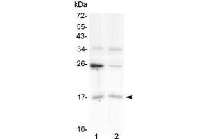 Western blot testing of human 1) U-87 MG and 2) placenta lysate with IL1F10 antibody at 0. (IL1F10 Antikörper)