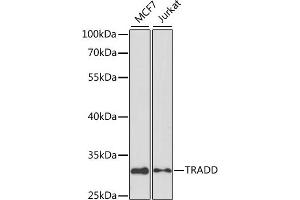 Western blot analysis of extracts of various cell lines, using TRADD antibody (ABIN3021541, ABIN3021542, ABIN3021543 and ABIN6215219) at 1:1000 dilution. (TRADD Antikörper)