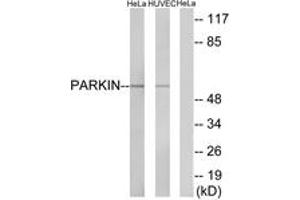 Western Blotting (WB) image for anti-Parkinson Protein 2, E3 Ubiquitin Protein Ligase (Parkin) (PARK2) (AA 101-150) antibody (ABIN2888688) (Parkin Antikörper  (AA 101-150))