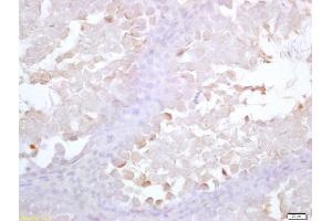 Formalin-fixed and paraffin embedded rat testis labeled with Anti-Acrosin Polyclonal Antibody, Unconjugated (ABIN1387665) at 1:200 followed by conjugation to the secondary antibody and DAB staining