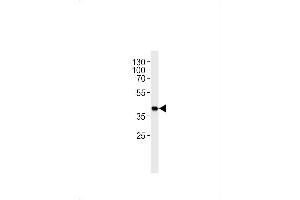 Mouse Sh2d5 Antibody (Center) (ABIN1881517 and ABIN2843619) western blot analysis in mouse heart tissue lysates (35 μg/lane). (SH2D5 Antikörper  (AA 200-230))