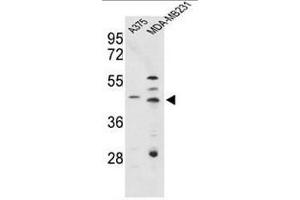 Western blot analysis of CTSD Antibody (C-term) in A375, MDA-MB231 cell line lysates (35µg/lane). (Cathepsin D Antikörper  (C-Term))