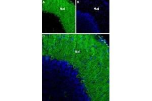 Immunohistochemistry (IHC) image for anti-Calcium Channel, Voltage-Dependent, T Type, alpha 1G Subunit (CACNA1G) (AA 1-22), (Intracellular) antibody (ABIN7043008)