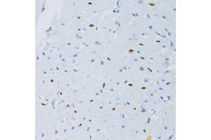 Immunohistochemistry of paraffin-embedded rat heart using SNRNP70 antibody. (SNRNP70 Antikörper  (AA 150-250))