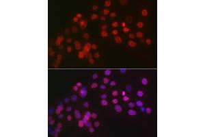 Immunofluorescence analysis of OVCAR-3 cells using WT1 Rabbit pAb (ABIN7271369) at dilution of 1:100 (40x lens). (WT1 Antikörper  (AA 1-302))