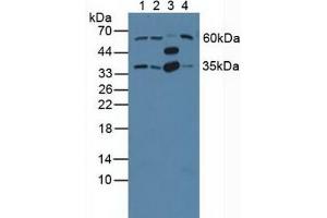 Figure. (GNB2 Antikörper  (AA 2-340))