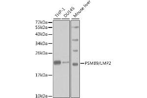 Western blot analysis of extracts of various cell lines, using PSMB9/LMP2 antibody (ABIN3022517, ABIN3022518, ABIN3022519 and ABIN6218874) at 1:1000 dilution. (PSMB9 Antikörper  (AA 1-219))