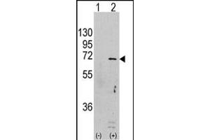 Western blot analysis of PRK (arrow) using rabbit polyclonal PRK Antibody  (ABIN391388 and ABIN2837970). (AMPK alpha Antikörper  (AA 474-502))