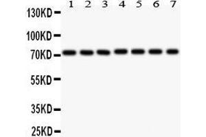 Anti- SDHA Picoband antibody, Western blotting All lanes: Anti SDHA  at 0. (SDHA Antikörper  (AA 44-380))