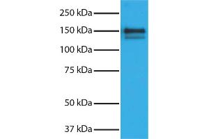 Purified Human Type I Collagen secondary antibody and chemiluminescent detection. (Esel anti-Ziege IgG (Heavy & Light Chain) Antikörper (HRP) - Preadsorbed)