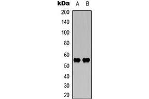 Western blot analysis of WASF3 expression in HEK293T (A), mouse brain (B) whole cell lysates. (WASF3 Antikörper  (Center))