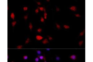Immunofluorescence (IF) image for anti-Filamin B, beta (FLNB) antibody (ABIN7260435)