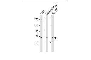 Western Blotting (WB) image for anti-Collagen, Type VIII, alpha 1 (COL8A1) (AA 62-89), (N-Term) antibody (ABIN1539505)