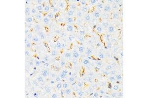 Immunohistochemistry of paraffin-embedded rat liver using CSK Rabbit mAb (ABIN1513217, ABIN3021034, ABIN3021035 and ABIN7101334) at dilution of 1:100 (40x lens). (CSK Antikörper)