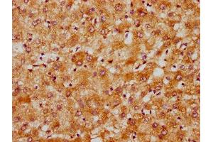 IHC image of  diluted at 1:300 and staining in paraffin-embedded human liver tissue performed on a Leica BondTM system. (DNAJC15 Antikörper  (AA 59-150))