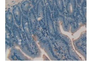 IHC-P analysis of Mouse Intestine Tissue, with DAB staining. (Retinoic Acid Receptor alpha Antikörper  (AA 237-459))