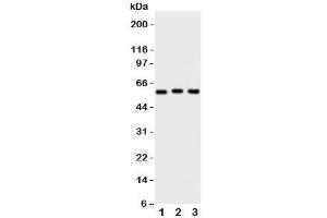 Western blot testing of PKM2 antibody and Lane 1:  HeLa;  2: MCF-7;  3: A549 cell lysate (PKM2 Antikörper  (N-Term))