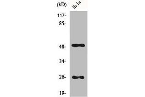 Western Blot analysis of Hela cells using Clusterin Polyclonal Antibody (Clusterin Antikörper  (C-Term))