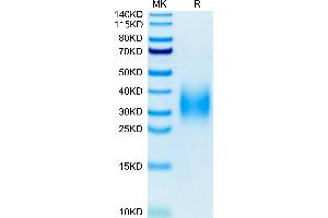 SDS-PAGE (SDS) image for Triggering Receptor Expressed On Myeloid Cells 2 (TREM2) (AA 19-174) protein (His tag) (ABIN7275788)
