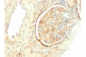 Formalin-fixed, paraffin-embedded human Kidney stained with CD61 Mouse Monoclonal Antibody (ITGB3/2145). (Integrin beta 3 Antikörper  (AA 385-490))