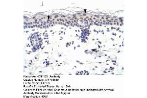Human Skin (ZNF223 Antikörper  (N-Term))