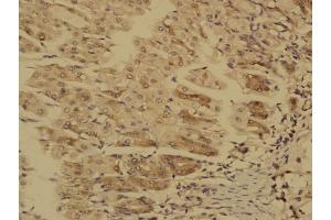 Paraformaldehyde-fixed, paraffin embedded Mouse stomach; Antigen retrieval by boiling in sodium citrate buffer (pH6. (MTM1 Antikörper  (AA 225-275))
