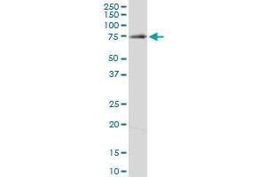 Image no. 4 for anti-Clathrin Interactor 1 (CLINT1) (AA 161-262) antibody (ABIN599495) (CLINT1 Antikörper  (AA 161-262))