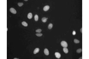 Immunofluorescent staining of A549 cells. (TOP2B Antikörper  (AA 1281-1494))