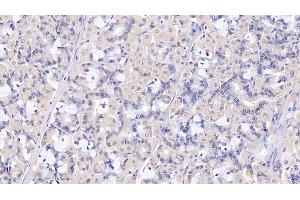 Immunohistochemistry (IHC) image for anti-Selectin P (Granule Membrane Protein 140kDa, Antigen CD62) (SELP) (AA 58-195) antibody (ABIN7432085)