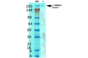 Western Blot analysis of Rat brain membrane lysate showing detection of Cav3. (CACNA1G Antikörper  (AA 2052-2172) (FITC))