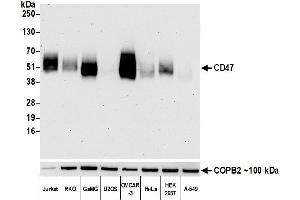 Western Blotting (WB) image for anti-CD47 (CD47) (AA 19-142) antibody (ABIN7449426)