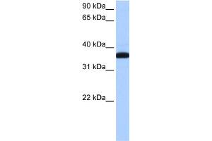 WB Suggested Anti-THEX1 Antibody Titration: 0. (ERI1 Antikörper  (N-Term))