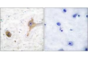 Immunohistochemistry analysis of paraffin-embedded human brain tissue, using GABA-B Receptor Antibody. (GABBR1 Antikörper  (AA 871-920))