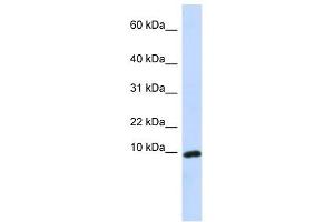 Western Blot showing CXCL9 antibody used at a concentration of 1-2 ug/ml to detect its target protein.