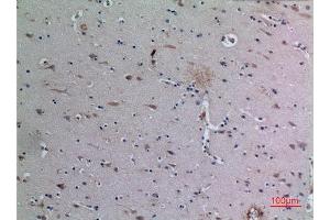 Immunohistochemistry (IHC) analysis of paraffin-embedded Human Brain, antibody was diluted at 1:100. (DPP7 Antikörper  (C-Term))