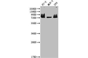 Western Blot Positive WB detected in: PC-3 whole cell lysate, MCF-7 whole cell lysate, 293 whole cell lysate All lanes: MEN1 antibody at 1:2000 Secondary Goat polyclonal to rabbit IgG at 1/50000 dilution Predicted band size: 69, 68, 64 kDa Observed band size: 75 kDa (Rekombinanter Menin Antikörper)